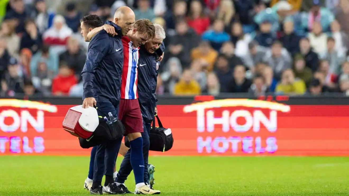 Arsenal Tanpa Odegaard di Laga vs Tottenham dan Manchester City